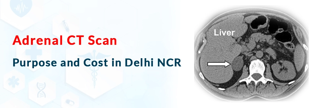 Adrenal CT Scan: Purpose and Cost in Delhi NCR